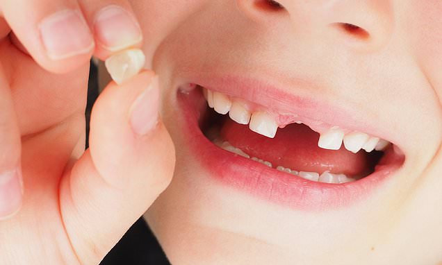 Teeth Can Predict Future Mental Health of Children, Says Study