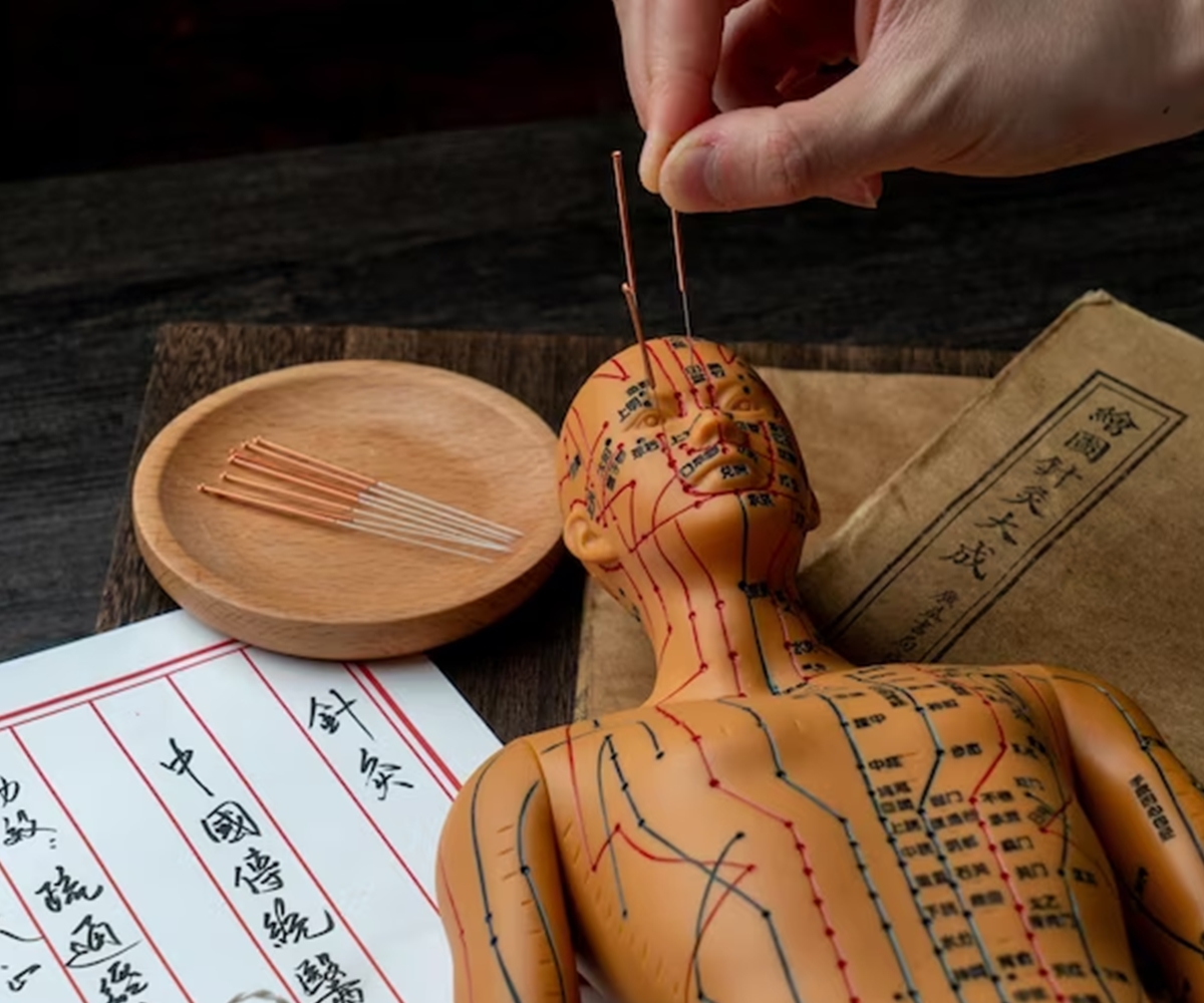 Achieving Wellness and Harmony, The Transformative Power of Acupuncture